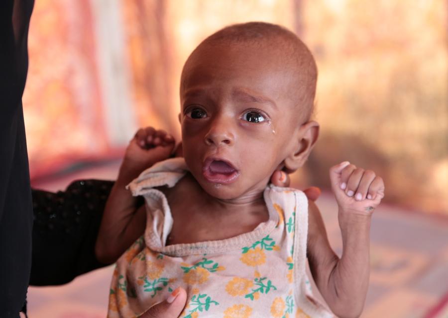 Crisi alimentare Yemen