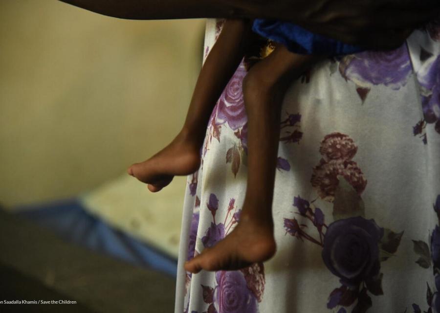 Piedi smagriti di un bambino in braccio alla madre