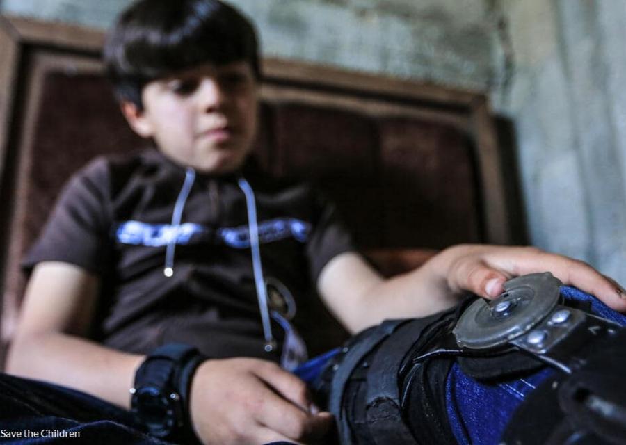 Bambino palestinese con ferita alla gamba dopo lo scoppio di una bomba
