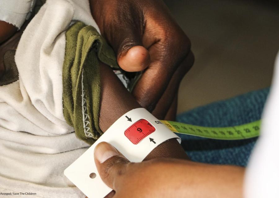 Braccio magro di un bambino etiope con attorno il braccialetto MUAC per misurare la sua grave malnutrizione