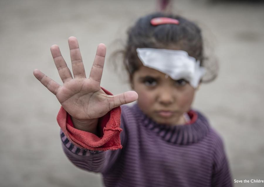 Bambina con un cerotto sull occhio sinistro fa un gesto di "stop" con la sua mano