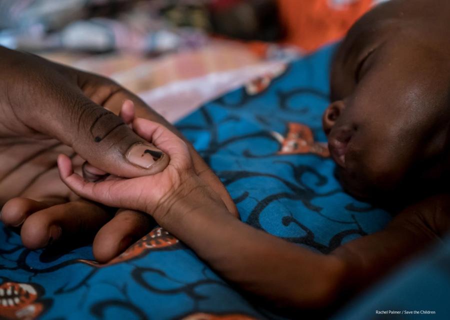 Bambino nigeriano affetto da malnutrizione acuta grave che dorme mentre una mano tiene teneramente la sua manina