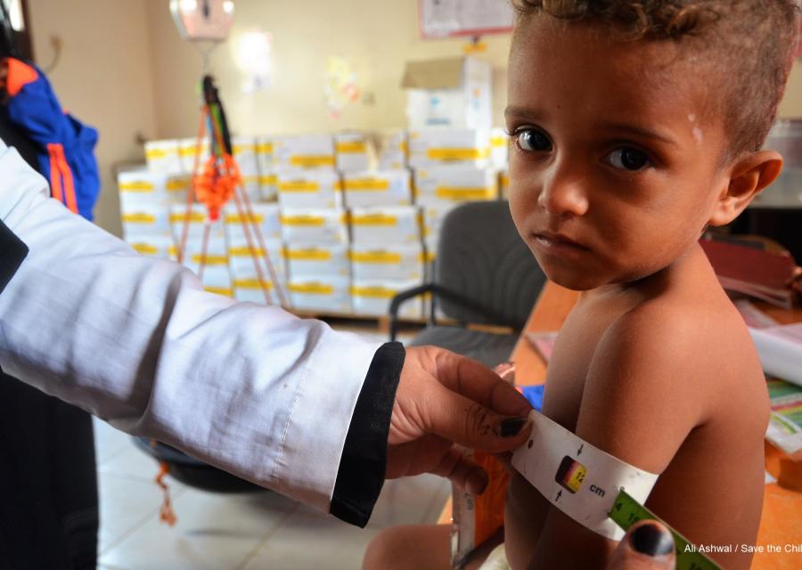 Malnutrizione Yemen