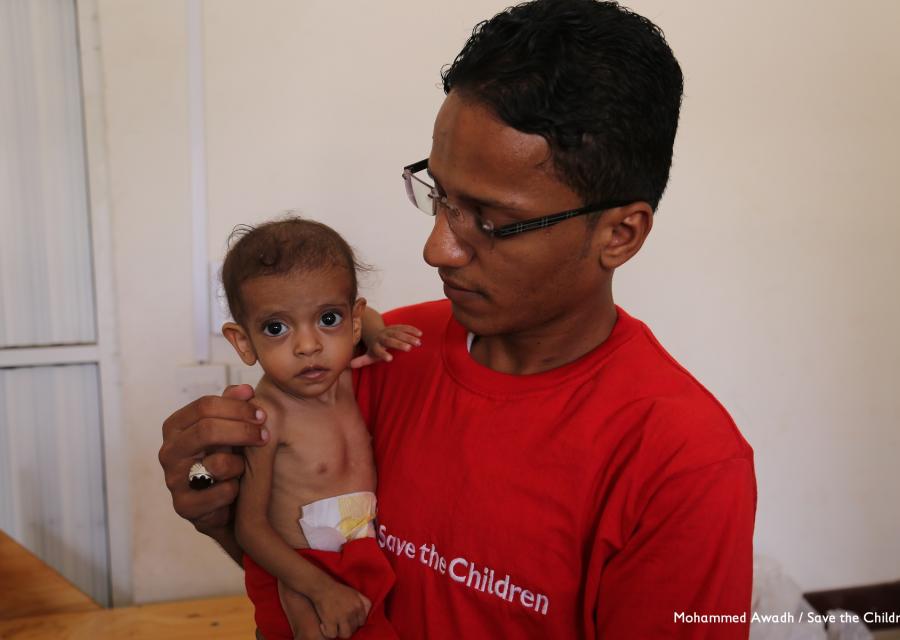 Bambino yemenita malnutrito in braccio a operatore Save the Children