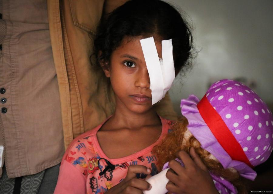 Bambina yemenita con bende sull'occhio sinistro abbraccia la sua bambola