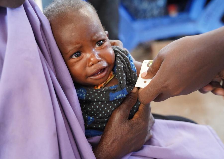bambina in braccio che piange mentre le misurano il livello di malnutrizione con il brsaccialetto MUAC